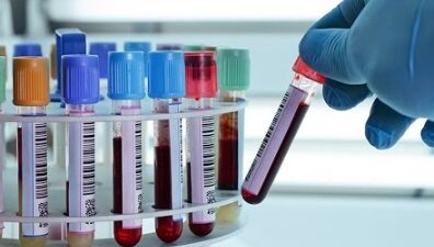 VM Medical Park Bursa Hastanesi Hematoloji Uzmanı Dr. Nihan Alkış,
